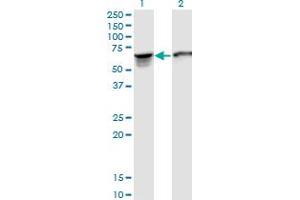 Western Blot analysis of STIP1 expression in transfected 293T cell line by STIP1 monoclonal antibody (M35), clone 2E11.