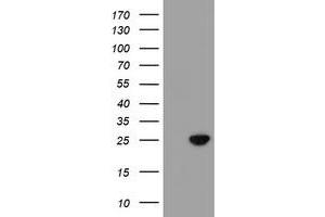 Western Blotting (WB) image for anti-Chromosome 21 Open Reading Frame 56 (C21orf56) antibody (ABIN1497041) (C21ORF56 anticorps)