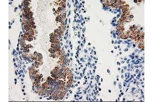 Image no. 9 for anti-Adenylate Kinase 4 (AK4) antibody (ABIN1496525)