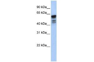 Desmin antibody used at 1 ug/ml to detect target protein. (Desmin anticorps  (Middle Region))
