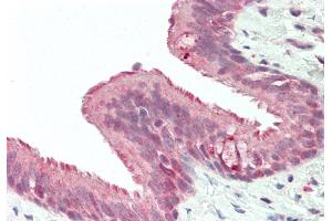 Rabbit Anti-RNF165 antibody  Formalin Fixed Paraffin Embedded Tissue: Human Lung, Respiratory Epithelium Primary antibody Concentration: 1:100 Secondary Antibody: Donkey anti-Rabbit-Cy3 Secondary Antibody Concentration: 1:200 Magnification: 20x Exposure Time: 0.