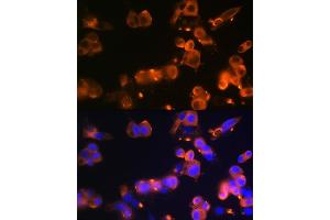 Immunofluorescence analysis of Hep G2 cells using GLUT2/SLC2 Rabbit mAb (ABIN7270414) at dilution of 1:100 (40x lens).
