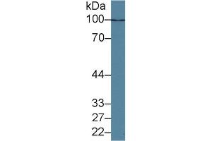 Detection of HDAC9 in Human K562 cell lysate using Polyclonal Antibody to Histone Deacetylase 9 (HDAC9)