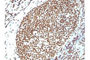 Formalin-fixed, paraffin-embedded human Tonsil stained with Histone H1 Rabbit Polyclonal Antibody. (Histone H1 anticorps)