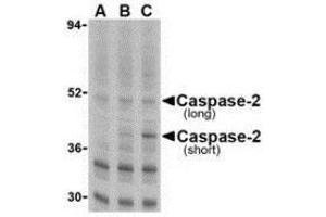 Western blot analysis of caspase-2 in Ramos cells with AP30196PU-N caspase-2 antibody at (A) 0. (Caspase 2 anticorps  (N-Term))