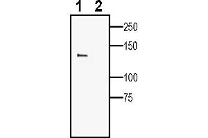 anti-Leptin Receptor (LEPR) (AA 777-791), (Extracellular) antibody
