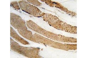 IHC analysis of FFPE human skeletal muscle tissue stained with PDK4 antibody
