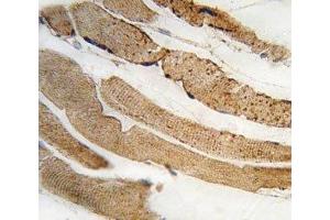 IHC analysis of FFPE human skeletal muscle tissue stained with PDK4 antibody (PDK4 anticorps  (AA 83-111))