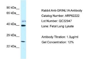 Western Blotting (WB) image for anti-Glutamate Receptor, Ionotropic, N-Methyl D-Aspartate-Like 1A (GRINL1A) (C-Term) antibody (ABIN2789070) (POLR2M anticorps  (C-Term))