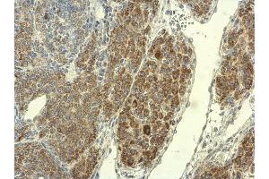 IHC-P Image PAD4 antibody detects PAD4 protein at cytoplasm on mouse ovary by immunohistochemical analysis.