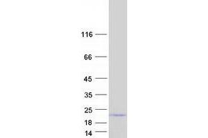 Validation with Western Blot