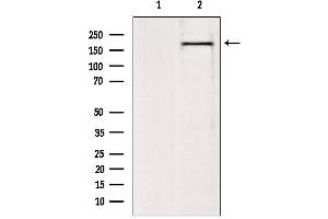 Western blot analysis of extracts from 293, using BAZ2A Antibody. (BAZ2A anticorps  (N-Term))
