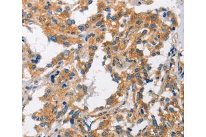 Immunohistochemistry (IHC) image for anti-Charged Multivesicular Body Protein 1A (CHMP1A) antibody (ABIN2423154) (CHMP1A anticorps)