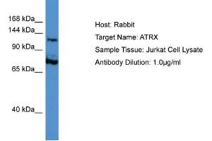Host: Rabbit Target Name: ATRX Sample Type: Jurkat Whole Cell lysates Antibody Dilution: 1. (ATRX anticorps  (C-Term))