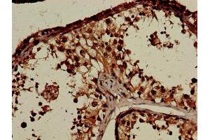 Immunohistochemistry of paraffin-embedded human testis tissue using ABIN7148482 at dilution of 1:100