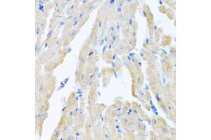 Immunohistochemistry of paraffin-embedded mouse heart using MLN antibody (ABIN6128307, ABIN6143890, ABIN6143891 and ABIN6222013) at dilution of 1:100 (40x lens).