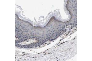Immunohistochemical staining of human skin shows weak cytoplasmic positivity in epidermal cells.