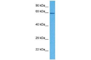 Host:  Rabbit  Target Name:  SLC15A4  Sample Tissue:  Human HepG2 Whole Cell  Antibody Dilution:  1ug/ml (SLC15A4 anticorps  (N-Term))