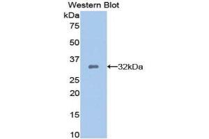 Western Blotting (WB) image for anti-Dickkopf Homolog 1 (DKK1) (AA 33-266) antibody (ABIN1858644) (DKK1 anticorps  (AA 33-266))