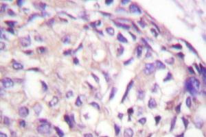 Immunohistochemistry analysis with AurA (pPro282) antibody on paraffin sections. (Aurora A anticorps)