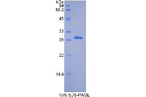 SDS-PAGE analysis of Human ADAM9 Protein.