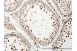 Immunoperoxidase of monoclonal antibody to USP29 on formalin-fixed paraffin-embedded human testis. (USP29 anticorps  (AA 131-240))