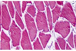 Anti-CAMK1D antibody IHC staining of human skeletal muscle. (CAMK1D anticorps  (AA 1-96))
