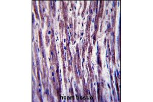 PTPLA Antibody (N-term) (ABIN657409 and ABIN2846449) immunohistochemistry analysis in formalin fixed and paraffin embedded human heart tissue followed by peroxidase conjugation of the secondary antibody and DAB staining. (PTPLA anticorps  (N-Term))