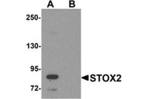 Western blot analysis of STOX2 in human kidney tissue lysate with STOX2 antibody at 1 μg/ml in (A) the absence and (B) the presence of blocking peptide.