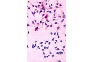 Immunocytochemical staining of HEK293 human embryonic kidney cells transfected (A) and untranfected (B) with C5AR1. (C5AR1 anticorps  (N-Term))