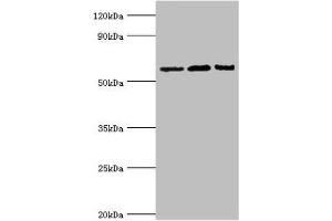 Western blot All lanes: Interleukin-10 receptor subunit alpha antibody at 8 μg/mL Lane 1: Mouse heart tissue Lane 2: Hela whole cell lysate Lane 3: Mouse liver tissue Secondary Goat polyclonal to rabbit IgG at 1/10000 dilution Predicted band size: 63 kDa Observed band size: 63 kDa (IL1RN anticorps  (AA 22-230))
