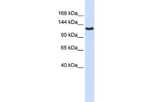 WB Suggested Anti-IGSF1 Antibody Titration:  0. (IGSF1 anticorps  (N-Term))