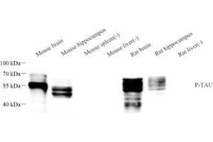 Western blot analysis of phospho-TAU (S202/T205) (ABIN7075838) at dilution of 1: 1000 (tau anticorps  (pSer202, pThr205))