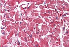 Human Heart: Formalin-Fixed, Paraffin-Embedded (FFPE)