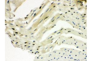 Anti- SLUG Picoband antibody,IHC(P) IHC(P): Mouse Cardiac Muscle Tissue
