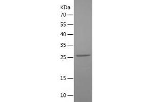 Cardiac Troponin I (TNNI3) (AA 2-211) protein (His tag)