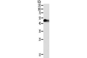Gel: 12 % SDS-PAGE, Lysate: 40 μg, Lane: Human fetal kidney tissue, Primary antibody: ABIN7131078(SLC12A1 Antibody) at dilution 1/200, Secondary antibody: Goat anti rabbit IgG at 1/8000 dilution, Exposure time: 1 minute (SLC12A1 anticorps)