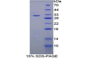 SDS-PAGE analysis of Rat Matrix Metalloproteinase 8 (MMP8) Protein. (MMP8 Protéine)
