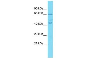 Host: Rabbit  Target Name: Mapk11  Sample Tissue: Rat Pancreas lysates  Antibody Dilution: 1. (MAPK11 anticorps  (N-Term))