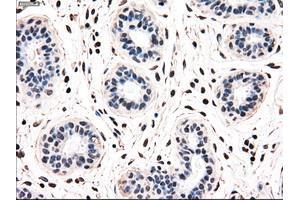 Immunohistochemical staining of paraffin-embedded breast tissue using anti-NRBP1 mouse monoclonal antibody. (NRBP1 anticorps)