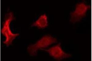 ABIN6275017 staining RAW264. (Claudin 6 anticorps  (Internal Region))