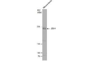 WB Image Mouse tissue extract (50 μg) was separated by 5% SDS-PAGE, and the membrane was blotted with ZO-1 antibody [N1N2], N-term , diluted at 1:500. (TJP1 anticorps  (N-Term))
