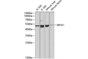 Western blot analysis of extracts of various cell lines using EPHX1 Polyclonal Antibody at dilution of 1:1000. (EPHX1 anticorps)