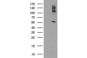 Western Blotting (WB) image for anti-Lipase, Endothelial (LIPG) antibody (ABIN1499172) (LIPG anticorps)