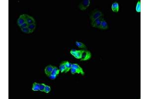 Immunofluorescent analysis of MCF-7 cells using ABIN7153625 at dilution of 1:100 and Alexa Fluor 488-congugated AffiniPure Goat Anti-Rabbit IgG(H+L)