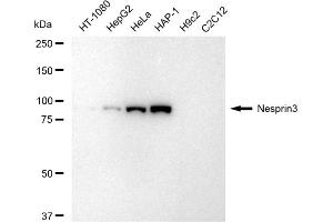Western blotting analysis using Nesprin3 antibody (ABIN7798074).