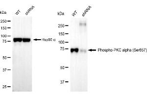 Western blotting analysis using Phospho-PKC alpha (Ser657) antibody (ABIN7799985). (Recombinant PKC alpha anticorps  (pSer657))