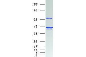 Validation with Western Blot