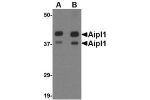 Western blot analysis of Aipl1 in rat brain tissue lysate with AP30037PU-N Aipl1 antibody at (A) 1 and (B) 2 μg/ml. (AIPL1 anticorps  (Center))