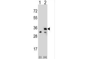 Western blot analysis of VDAC1 (arrow) using rabbit polyclonal VDAC1 Antibody (Center) (ABIN390564 and ABIN2840894). (VDAC1 anticorps  (AA 95-124))